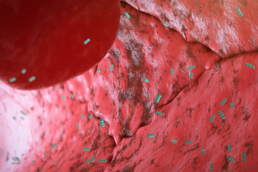 Endothelial injury syndrome